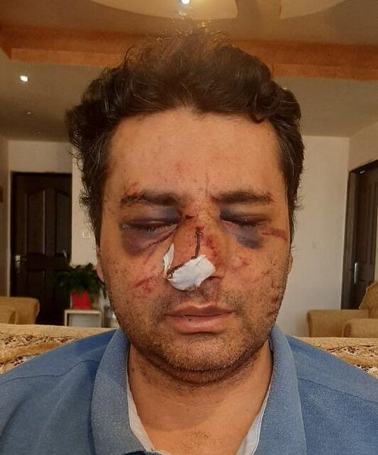 ضرب و شتم شدید یک متخصص بیهوشی توسط همراهان یک بیمار در پیرانشهر